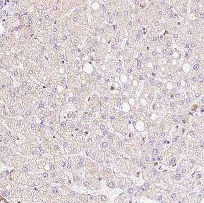 Immunohistochemistry-Paraffin: GBAS Antibody [NBP2-38984]