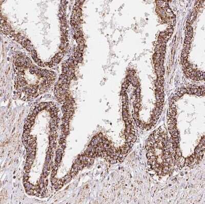 Immunohistochemistry-Paraffin: GBAS Antibody [NBP2-38984]