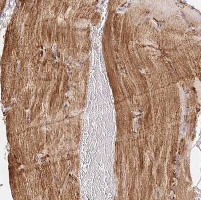 Immunohistochemistry-Paraffin: GBAS Antibody [NBP2-38984]
