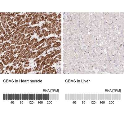 Immunohistochemistry-Paraffin: GBAS Antibody [NBP2-38984]