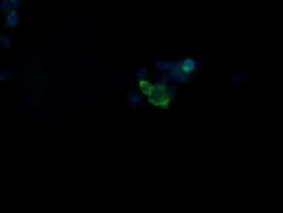 Immunocytochemistry/ Immunofluorescence: GBAS Antibody (OTI1B8) - Azide and BSA Free [NBP2-70804]