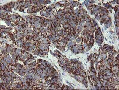 Immunohistochemistry: GBAS Antibody (OTI1B8) - Azide and BSA Free [NBP2-70804]