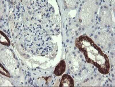 Immunohistochemistry: GBAS Antibody (OTI1B8) - Azide and BSA Free [NBP2-70804]