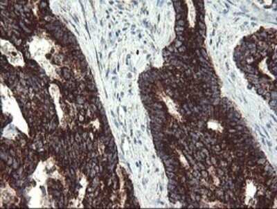 Immunohistochemistry: GBAS Antibody (OTI1B8) [NBP2-45730]