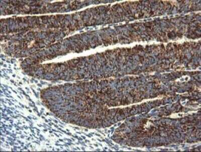 Immunohistochemistry: GBAS Antibody (OTI1B8) [NBP2-45730]