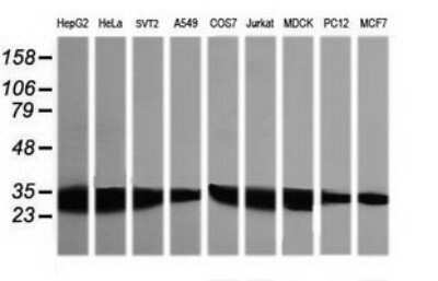 Western Blot: GBAS Antibody (OTI1B8) [NBP2-45730]