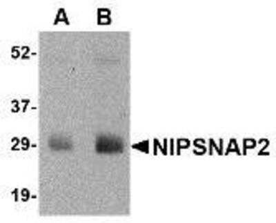 Western Blot: GBAS AntibodyBSA Free [NBP1-76966]