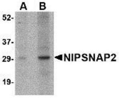 Western Blot: GBAS AntibodyBSA Free [NBP1-77339]