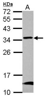 Western Blot: GBAS Antibody [NBP2-16616]