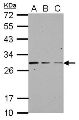 Western Blot: GBAS Antibody [NBP2-16617]