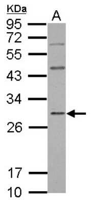 Western Blot: GBAS Antibody [NBP2-16618]