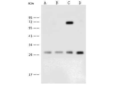 Western Blot: GBAS Antibody [NBP2-99373]