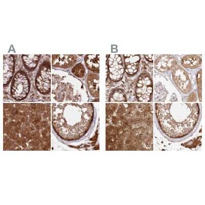 Immunohistochemistry-Paraffin: GBE1 Antibody [NBP1-85875]