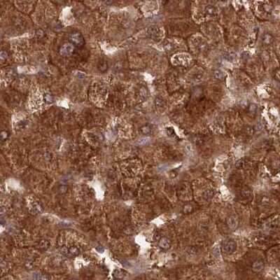 Immunohistochemistry-Paraffin: GBE1 Antibody [NBP1-85875]