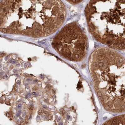 Immunohistochemistry-Paraffin: GBE1 Antibody [NBP1-85875]