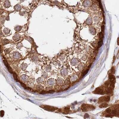 Immunohistochemistry-Paraffin: GBE1 Antibody [NBP1-85875]