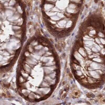 Immunohistochemistry-Paraffin: GBE1 Antibody [NBP1-85875]