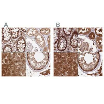 Immunohistochemistry-Paraffin: GBE1 Antibody [NBP1-85876]