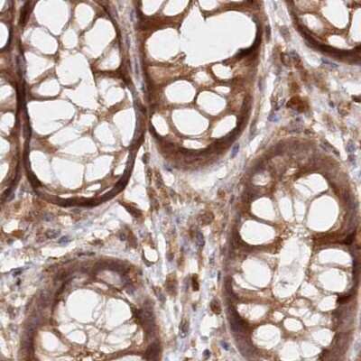 Immunohistochemistry-Paraffin: GBE1 Antibody [NBP1-85876]