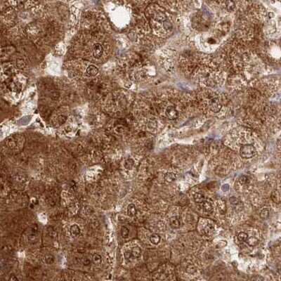 Immunohistochemistry-Paraffin: GBE1 Antibody [NBP1-85876]