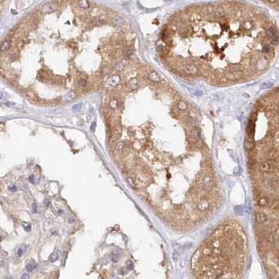 Immunohistochemistry-Paraffin: GBE1 Antibody [NBP1-85876]