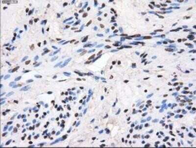 Immunohistochemistry: GBE1 Antibody (OTI1D11) - Azide and BSA Free [NBP2-70810]