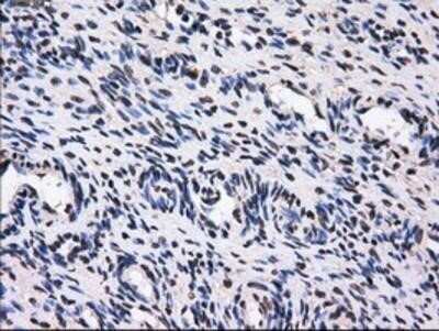 Immunohistochemistry: GBE1 Antibody (OTI1D11) - Azide and BSA Free [NBP2-70810]