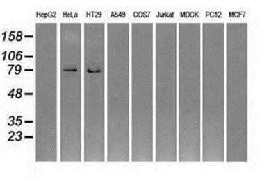 Western Blot: GBE1 Antibody (OTI1D11)Azide and BSA Free [NBP2-70810]