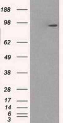 Western Blot: GBE1 Antibody (OTI1D11)Azide and BSA Free [NBP2-70810]