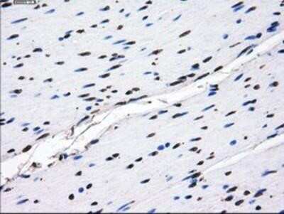 Immunohistochemistry-Paraffin: GBE1 Antibody (OTI1D11) [NBP2-02245]