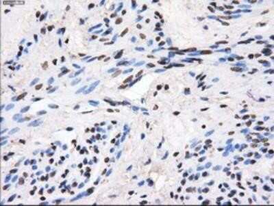 Immunohistochemistry-Paraffin: GBE1 Antibody (OTI1D11) [NBP2-02245]