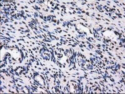 Immunohistochemistry-Paraffin: GBE1 Antibody (OTI1D11) [NBP2-02245]