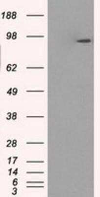 Western Blot: GBE1 Antibody (OTI1D11) [NBP2-02245]