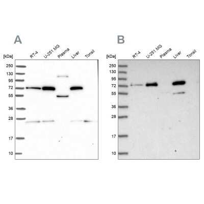 Western Blot: GBE1 Antibody [NBP1-85875]