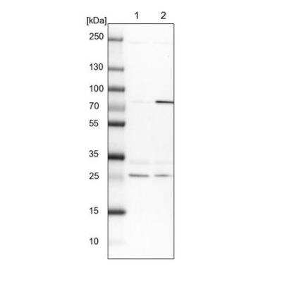 Western Blot: GBE1 Antibody [NBP1-85875]