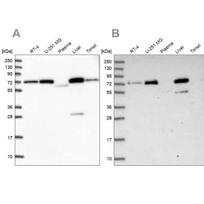 Western Blot: GBE1 Antibody [NBP1-85876]