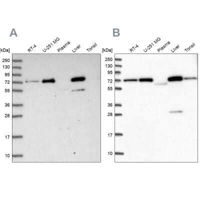 Western Blot: GBE1 Antibody [NBP1-85877]