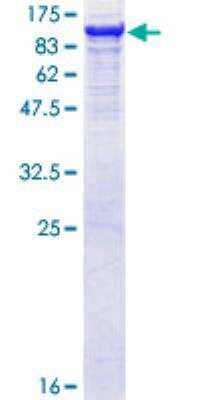 SDS-PAGE: Recombinant Human GBE1 GST (N-Term) Protein [H00002632-P01]