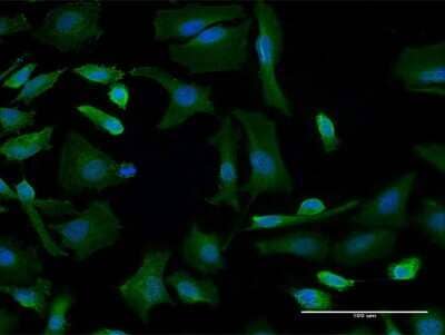 Immunocytochemistry/ Immunofluorescence: GBF1 Antibody (4B2) [H00008729-M04]