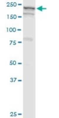 Western Blot: GBF1 Antibody (4B2) [H00008729-M04]