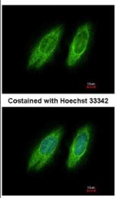 Immunocytochemistry/ Immunofluorescence: GBF1 Antibody [NBP2-16619]