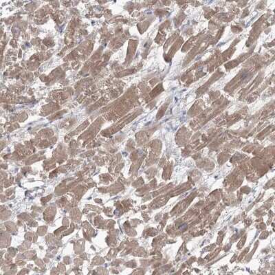 Immunohistochemistry-Paraffin: GBF1 Antibody [NBP1-88844]