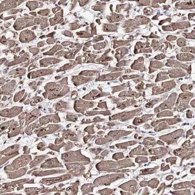 Immunohistochemistry-Paraffin: GBF1 Antibody [NBP2-14039]