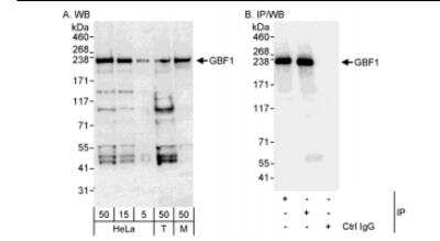 Immunoprecipitation: GBF1 Antibody [NBP1-06526]