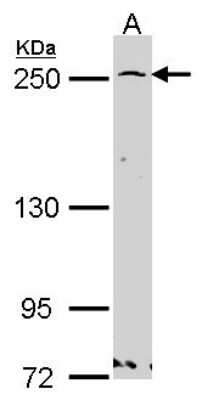 Western Blot: GBF1 Antibody [NBP2-16619]