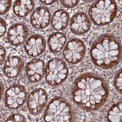 Immunohistochemistry-Paraffin: GBGT1 Antibody [NBP2-14040]