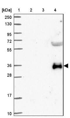 Western Blot: GBGT1 Antibody [NBP2-14040]