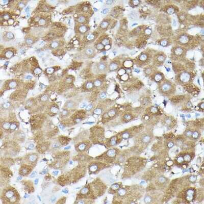 Immunohistochemistry-Paraffin: GBL Antibody - Azide and BSA Free [NBP3-03451]