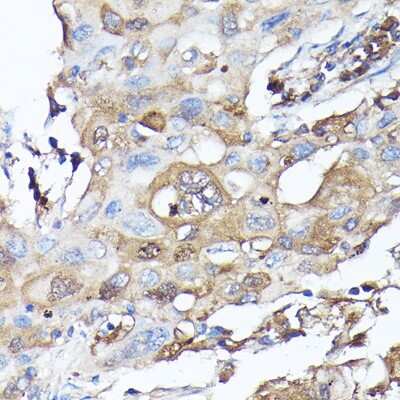 Immunohistochemistry-Paraffin: GBL Antibody - Azide and BSA Free [NBP3-03451]