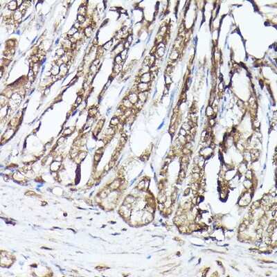 Immunohistochemistry-Paraffin: GBL Antibody - Azide and BSA Free [NBP3-03451]